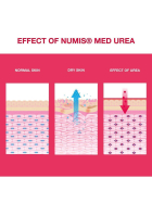 numis med UREA 25% Schrundensalbe, 50 ml