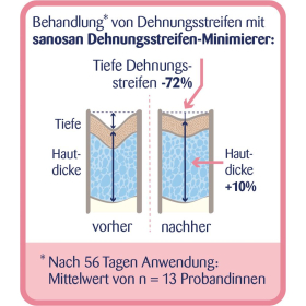 sanosan Dehnungsstreifen Minimierer, 75 ml